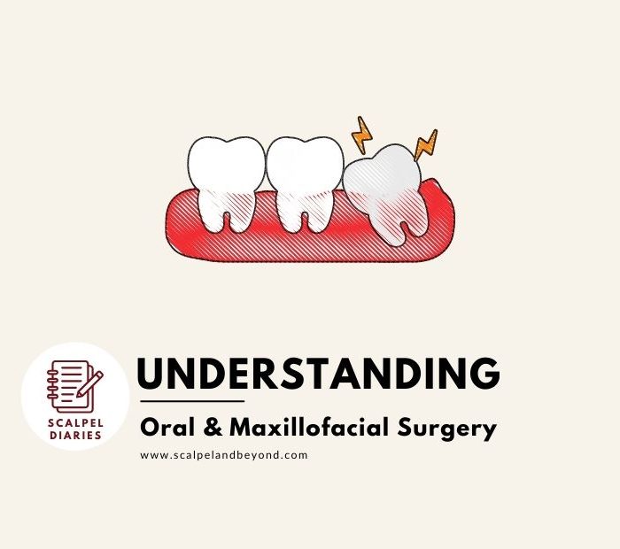 Understanding Oral and Maxillofacial Surgery
